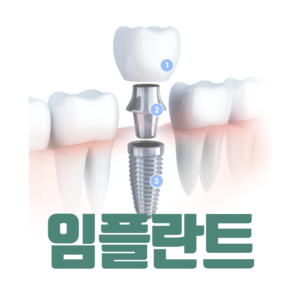 세종 종촌동 임플란트 가격 싼곳 | 잘하는곳 | 잘하는 병원 치과 | 의료 보험 적용